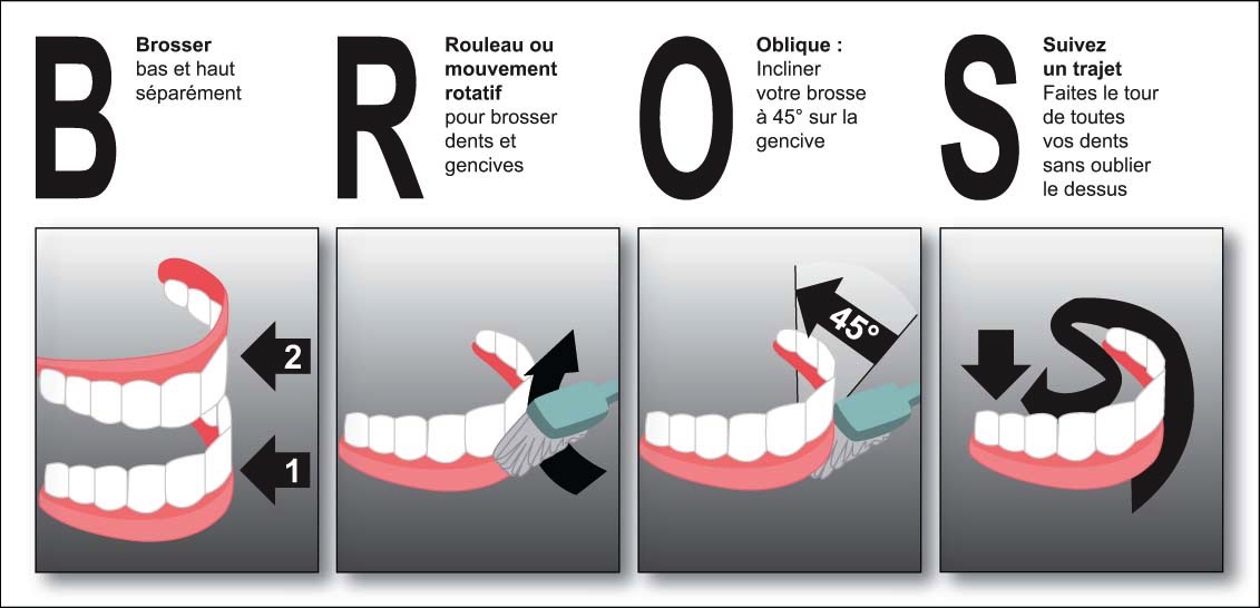 Conseils aux patients Langon brossage des dents