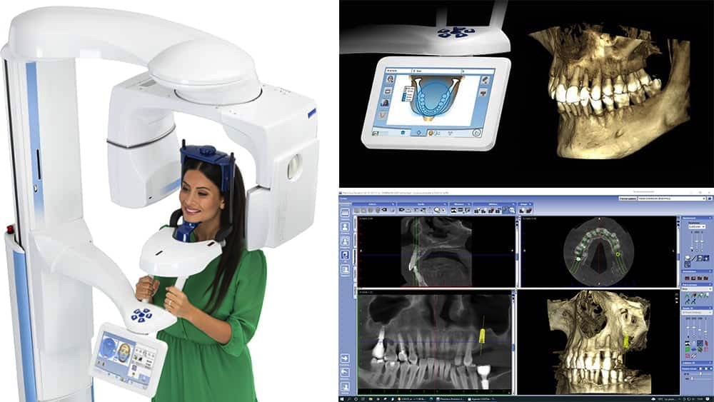 dentiste Langon scanner panoramique